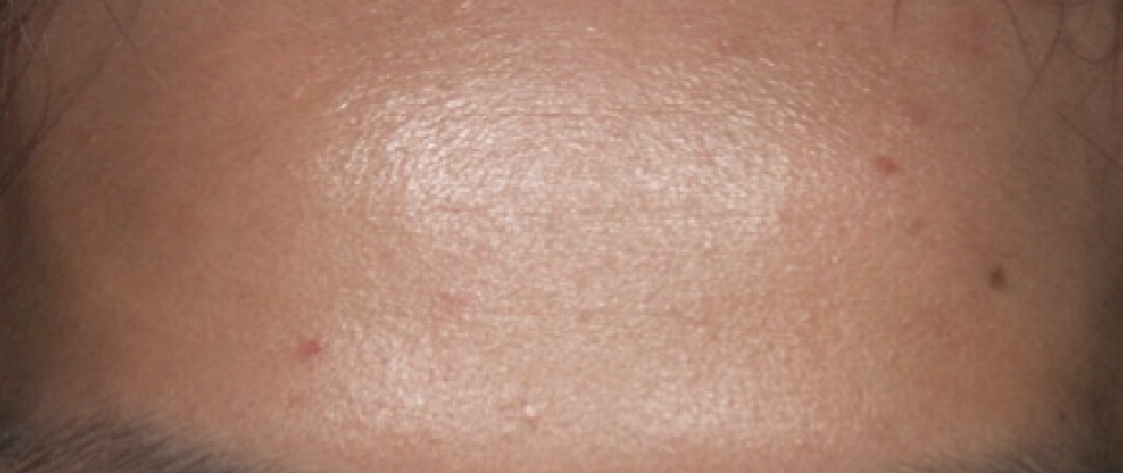smooth and glare-free skin of young men