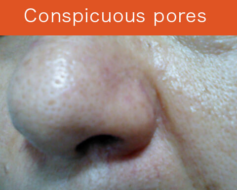 Conspicuous pores