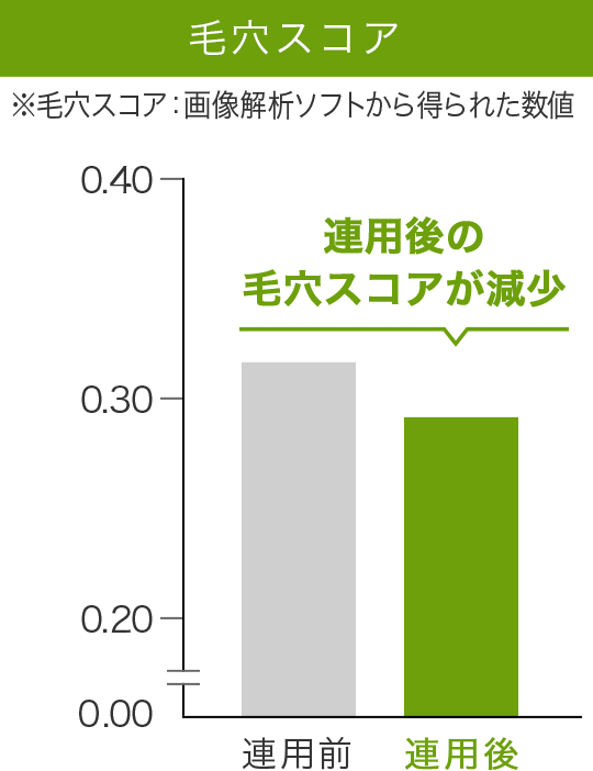 毛穴スコアのグラフ