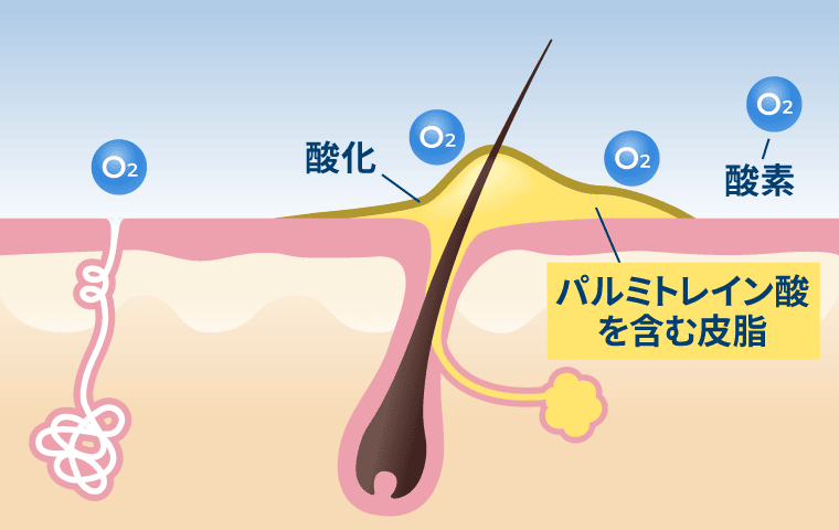 加齢臭の発生メカニズム2