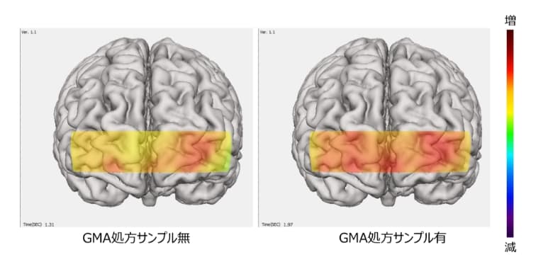 プレゼンテーション中の脳血流変化画像