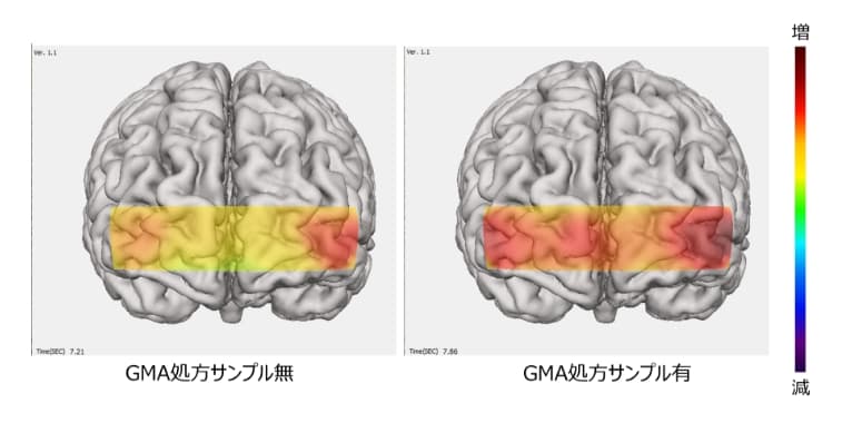 計算課題中の脳血流変化画像