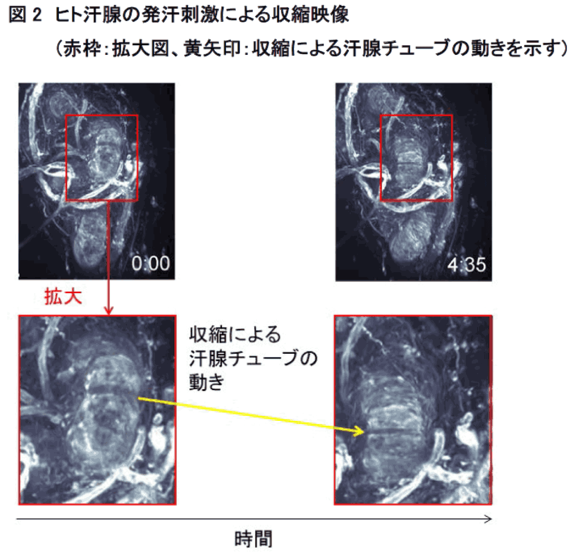 （図2）ヒト汗腺の発汗刺激による収縮映像(赤枠：拡大図、黄矢印：収縮による汗腺チューブの動きを示す)